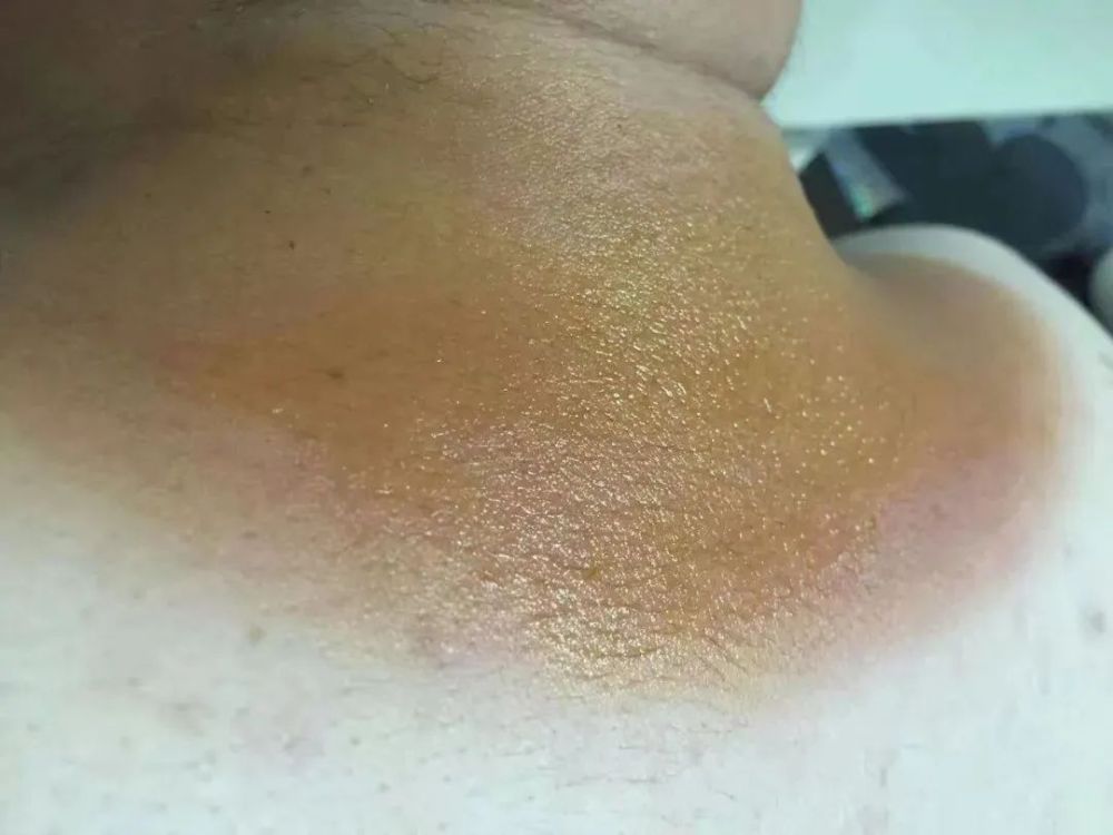 1676200596063093268.jpg
